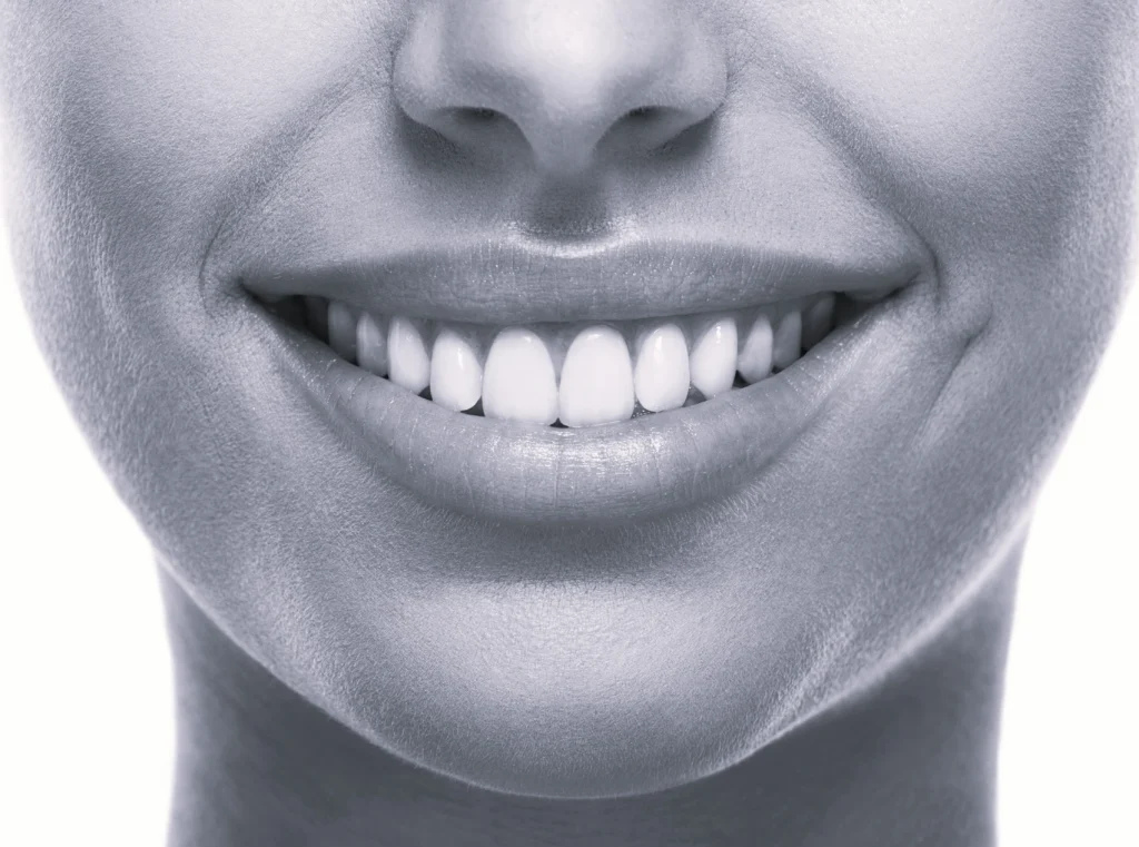 woman smiling with teeth